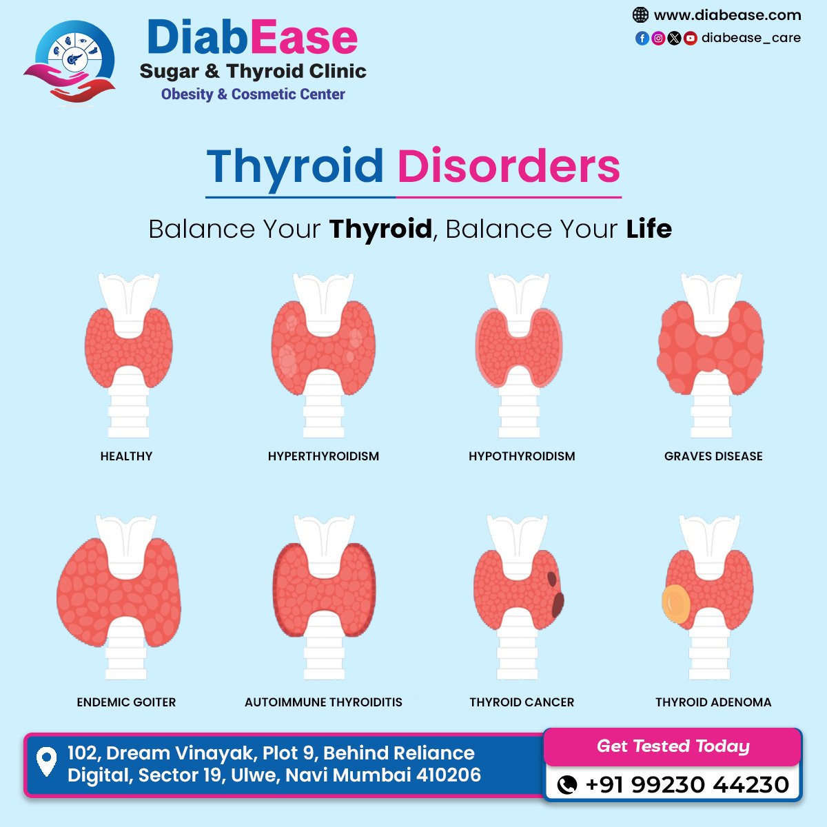 How Does Thyroid Begin?